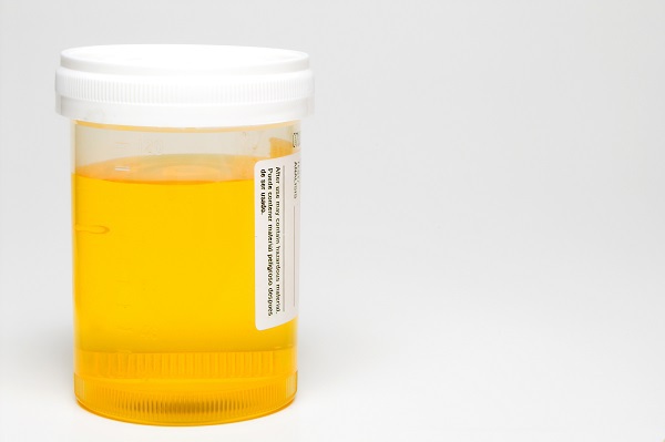 The Science Behind Blood Alcohol Urine Tests